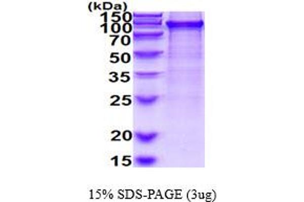 UBA2 Protein (AA 1-640) (His tag)