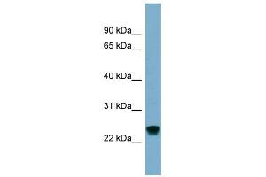 RAB22A antibody used at 1 ug/ml to detect target protein. (RAB22A 抗体  (Middle Region))