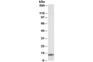 Western blot testing of human duodenum lysate with B2M antibody at 0. (beta-2 Microglobulin 抗体)