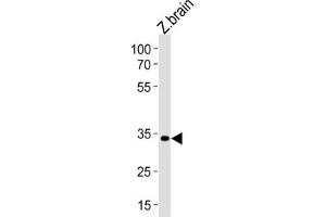 Western Blotting (WB) image for anti-Paired Box Gene 2a (PAX2A) antibody (ABIN3004629) (PAX2A 抗体)