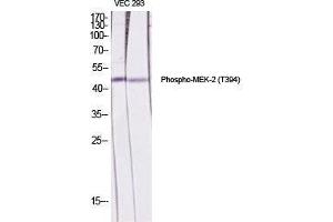 Western Blot (WB) analysis of specific cells using Phospho-MEK-2 (T394) Polyclonal Antibody. (MEK2 抗体  (pThr394))