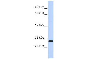 SETD4 antibody used at 0. (SETD4 抗体  (C-Term))