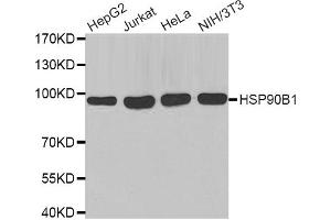 Western blot analysis of extracts of various cell lines, using HSP90B1 antibody (ABIN2968872). (GRP94 抗体)