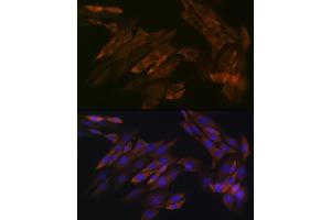 Immunofluorescence analysis of NIH-3T3 cells using DDX6 Rabbit mAb (ABIN7266703) at dilution of 1:100 (40x lens). (DDX6 抗体)