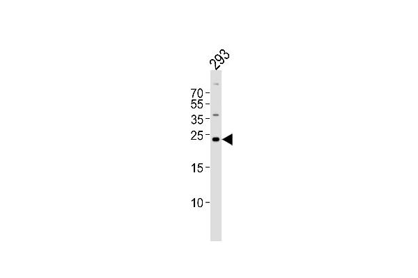 GADD45GIP1 抗体  (N-Term)