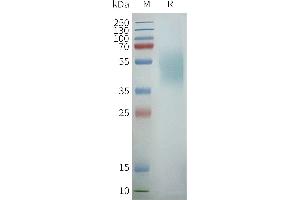 Human C-Nanodisc, Flag Tag on SDS-PAGE (CXCR7 蛋白)