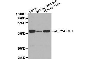 Western Blotting (WB) image for anti-Adenylate Cyclase Activating Polypeptide 1 (Pituitary) Receptor Type I (ADCYAP1R1) antibody (ABIN6220077) (ADCYAP1R1 抗体)