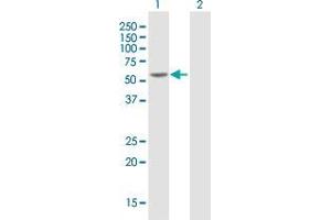 Western Blot analysis of HNF4A expression in transfected 293T cell line by HNF4A MaxPab polyclonal antibody. (HNF4A 抗体  (AA 1-464))