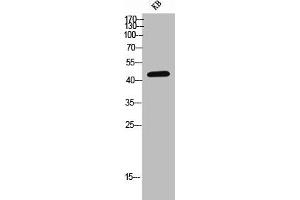 Western Blot analysis of KB cells using CD155 Polyclonal Antibody (Poliovirus Receptor 抗体  (Internal Region))