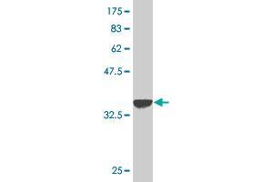 Western Blot detection against Immunogen (37. (Keratin 10 抗体  (AA 345-454))