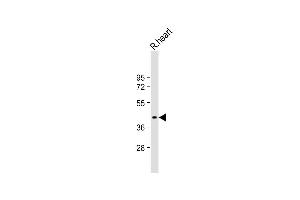 Anti-GDE1 Antibody (Center) at 1:1000 dilution + Rat heart lysate Lysates/proteins at 20 μg per lane. (GDE1 抗体  (AA 192-219))