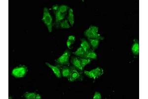 Immunofluorescent analysis of HepG2 cells using ABIN7168172 at dilution of 1:100 and Alexa Fluor 488-congugated AffiniPure Goat Anti-Rabbit IgG(H+L) (RPS6KA1 抗体  (AA 233-400))