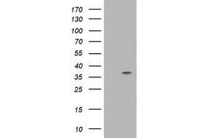 Western Blotting (WB) image for anti-Ras Association (RalGDS/AF-6) Domain Family Member 1 (RASSF1) antibody (ABIN1500609) (RASSF1 抗体)