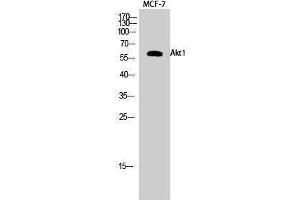 Western Blotting (WB) image for anti-V-Akt Murine Thymoma Viral Oncogene Homolog 1 (AKT1) (Ser137) antibody (ABIN6284493) (AKT1 抗体  (Ser137))