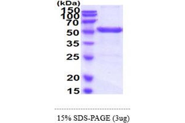 UMPS Protein (AA 1-480) (His tag)