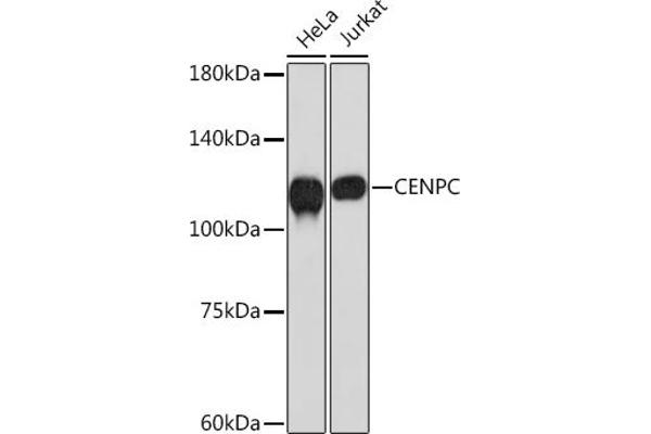 Centromere Protein C Pseudogene 1 (CENPCP1) 抗体