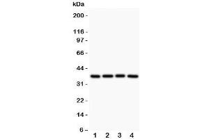 Western blot testing of MCL1 antibody and Lane 1:  rat spleen;  2: human HEPG2;  3: (h) MCF-7;  4: (h) COLO320 (MCL-1 抗体  (AA 1-350))