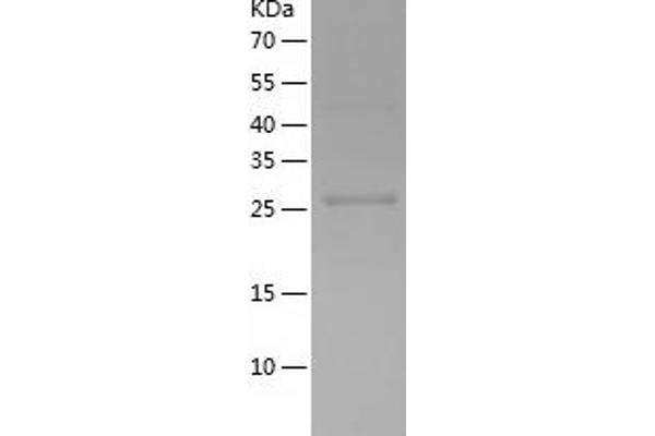 TWF1 Protein (AA 100-350) (His tag)