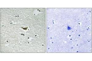 Immunohistochemistry analysis of paraffin-embedded human brain, using CK-1 alpha (Phospho-Tyr294) Antibody. (CSNK1A1 抗体  (pTyr294))