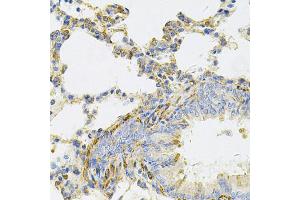 Immunohistochemistry of paraffin-embedded rat lung using UBE2B Antibody. (UBE2B 抗体)