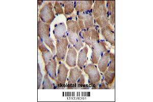 SEPN1 Antibody immunohistochemistry analysis in formalin fixed and paraffin embedded human skeletal muscle followed by peroxidase conjugation of the secondary antibody and DAB staining. (SEPN1 抗体  (C-Term))