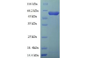 SDS-PAGE (SDS) image for Glyco (AA 20-459) protein (His-SUMO Tag) (ABIN5711149) (Glyco (AA 20-459) protein (His-SUMO Tag))