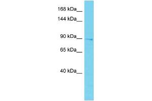 Host: Rabbit Target Name: EPS15L1 Sample Type: Placenta lysates Antibody Dilution: 1. (EPS15L1 抗体  (C-Term))