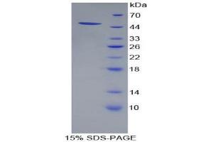 SDS-PAGE (SDS) image for Proteasome (Prosome, Macropain) 26S Subunit, ATPase, 4 (PSMC4) (AA 1-418) protein (His tag) (ABIN1879271) (PSMC4 Protein (AA 1-418) (His tag))