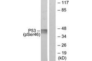 Western blot analysis of extracts from 293 cells treated with UV, using p53 (Phospho-Ser46) Antibody. (p53 抗体  (pSer46))