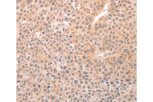 Immunohistochemistry (IHC) image for anti-Transient Receptor Potential Cation Channel, Subfamily C, Member 3 (TRPC3) antibody (ABIN2426986) (TRPC3 抗体)