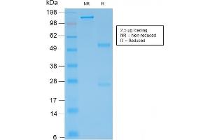 SDS-PAGE (SDS) image for anti-Glial Fibrillary Acidic Protein (GFAP) antibody (ABIN6939508)