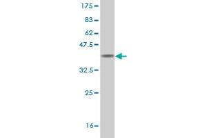 Western Blot detection against Immunogen (36. (INPP5A 抗体  (AA 288-387))