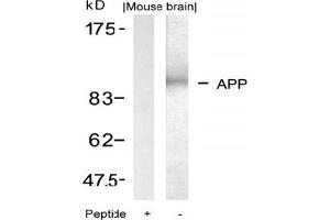 Image no. 1 for anti-Amyloid beta (A4) Precursor Protein (APP) (AA 666-670) antibody (ABIN197432)