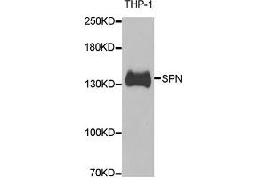 Western blot analysis of extracts of THP-1 cells, using SPN antibody. (CD43 抗体)