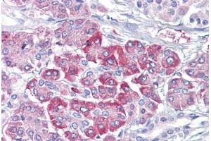 Anti-NRAS antibody IHC staining of human pancreas. (GTPase NRas 抗体)