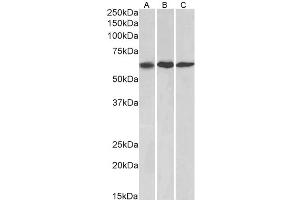 Western Blotting (WB) image for anti-Matrix Metallopeptidase 14 (Membrane-inserted) (MMP14) antibody (ABIN5928778) (MMP14 抗体)