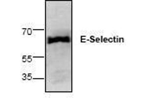Image no. 1 for anti-Selectin E (SELE) antibody (ABIN127258) (Selectin E/CD62e 抗体)