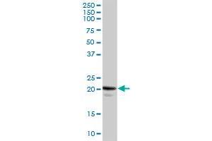 CAV1 MaxPab rabbit polyclonal antibody. (Caveolin-1 抗体  (AA 1-178))