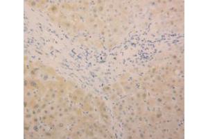 IHC-P analysis of Human Liver Tissue, with DAB staining. (ALT 抗体  (AA 367-480))