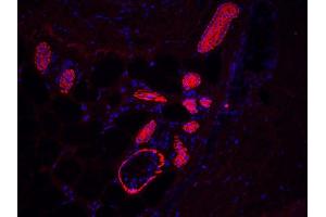 human sole sweat gland (courtesy of L. (KRT17 抗体)