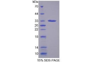 SDS-PAGE analysis of Human GBP1 Protein. (GBP1 蛋白)