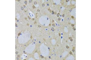 Immunohistochemistry of paraffin-embedded mouse brain using YWHAZ antibody. (14-3-3 zeta 抗体)