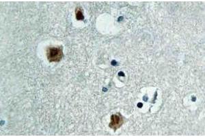 Immunohistochemistry (IHC) analyzes of PAKbeta antibody in paraffin-embedded human brain tissue. (PAK3 抗体)