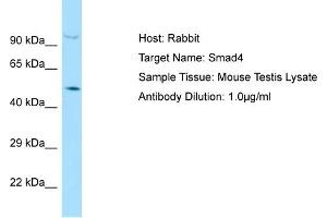 Host: Rabbit Target Name: SMAD4 Sample Tissue: Mouse Testis Antibody Dilution: 1ug/ml (SMAD4 抗体  (C-Term))