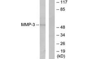Western Blotting (WB) image for anti-Matrix Metallopeptidase 3 (Stromelysin 1, Progelatinase) (MMP3) (AA 421-470) antibody (ABIN2889233) (MMP3 抗体  (AA 421-470))