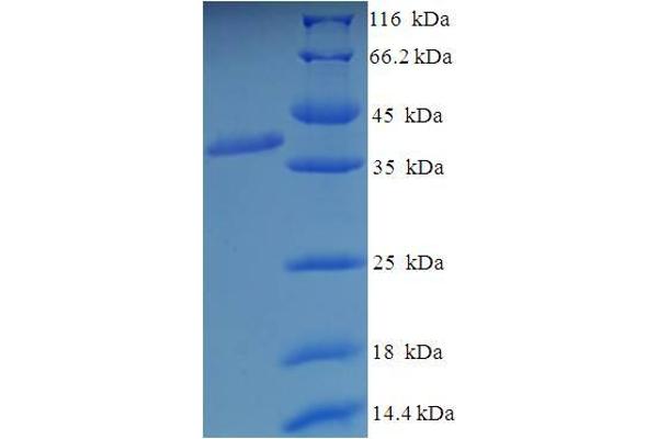 GRIK5 Protein (AA 143-238, Extracellular) (GST tag)