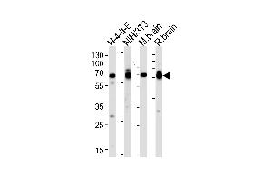 Western blot analysis of lysates from H-4-II-E, mouse NIH/3T3 cell line, mouse brain and rat brain tissues (from left to right), using STIP1 Antibody at 1:1000 at each lane. (STIP1 抗体  (C-Term))