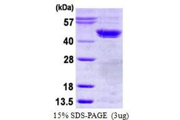 CSNK2A1/CK II alpha Protein (His tag)