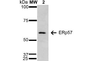 Western Blot analysis of Human Cervical Cancer cell line (HeLa) showing detection of 57 kDa Erp57 protein using Mouse Anti-Erp57 Monoclonal Antibody, Clone 4F9 . (PDIA3 抗体  (AA 25-505) (Atto 594))