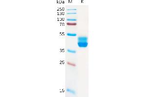 CNR2 Protein (AA 1-33) (Fc Tag)